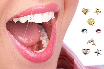 zubní šperk